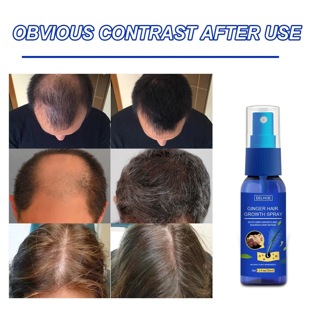 Ginger Hair Growth spray Anti  Fall  Loss Treatment   Essence Oil for Men Women hair treatment