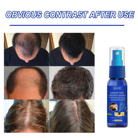 Ginger Hair Growth spray Anti  Fall  Loss Treatment   Essence Oil for Men Women hair treatment