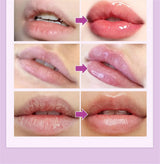 Remove Dark Lip Balm Fast Lightening Pink Lip Exfoliating Fade Lip Line Dead Skin Moisturizer Korean Care Products Beauty Health