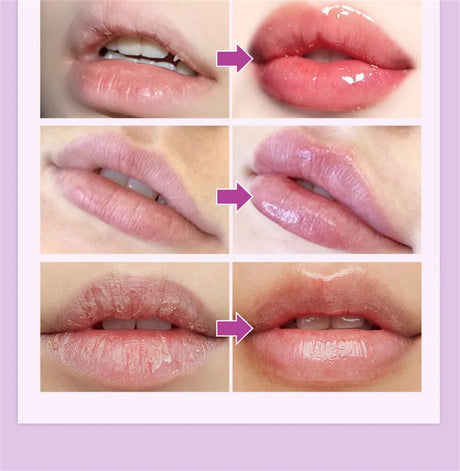 Remove Dark Lip Balm Fast Lightening Pink Lip Exfoliating Fade Lip Line Dead Skin Moisturizer Korean Care Products Beauty Health