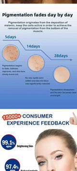 Dark Spot Remover for Face Removing Freckle Chloasma Senile Plaques Sunburn Cyasma Chorioplaque Freckle Cream