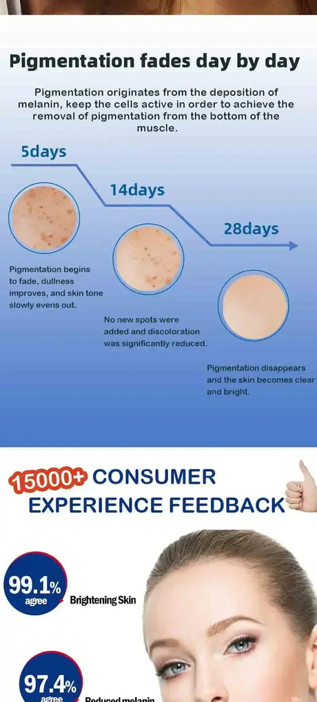 Dark Spot Remover for Face Removing Freckle Chloasma Senile Plaques Sunburn Cyasma Chorioplaque Freckle Cream