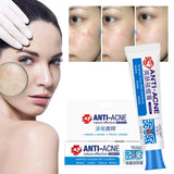 Herbal Acne Removal Face Cream Clears Pimple Scar Black Dots Gel Acne Treatment Shrink Pore Skin Whitening Lightening Ointment