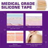 Silicone Scar Sheets - Reusable Scar Tape for Keloid, C-Section, Surgery, Burn, Acne - Waterproof, Hypoallergenic, Latex-Free