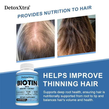 Biotin 20000mcg + Zinc + Keratin Capsules - Hair Growth, Strong Nails, Radiant Skin & Joint Support, Anti-aging Supplements