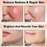 B5 Repair Cream Moisturizing Hydrating Effectively Solves Dry Chapped And Red Skin Nourishes Improve Repair Sunscreen Cream