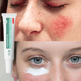 Instant Facial Redness Repair Cream Soothing Red Blood Rosacea Treatment Improve Sensitive Skin Anti Redness Skin Care Cosmetics