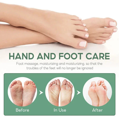 Herbal Anti Crack Foot Cream Spray Heel Cracking Repair Products Exfoliation Dead Skin Removal Softening Moisturize Smooth Care