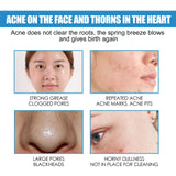 1/3/5PCS B5 Moisturizing Cream Hydrating Solves Dry Chapped Red Skin Nourishing Improve Sunscreen Korean Beauty Face Skin Care