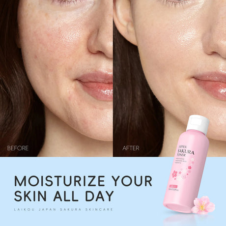 LAIKOU Japan Sakura Toner with Niacinamide Hyaluronic Acid Vitamin C 100ml - Moisturizing Refreshing Gentle