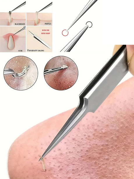 1 Pack Extra Fine No. 5 Cellular Acne Blackhead Tweezers - Facial Beauty Remove Acne Needle Tools for Skin Care