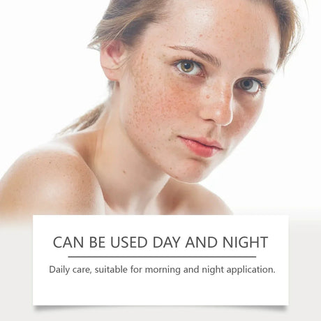 SADOER Anti Freckle Cream Face Brightening Creams Spot Removing Anti-aging Moisturizing Freckles Removal Facial Cream Skin Care