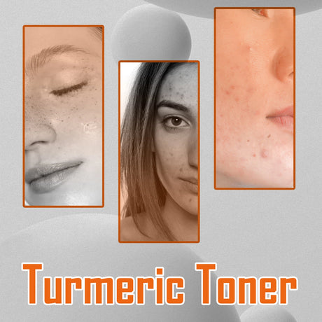 Turmeric Toner Dark Spots Removal Brightening Spots Corrector Remove Freckle Fade Melasma Moisturizing Turmeric Face Toner