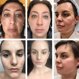 Powerful Spot-Removing Whiten Cream Brighten Skin Fast Eliminates Melanin Pigmentation Melasma Dark Spots Korean Face Skin Care