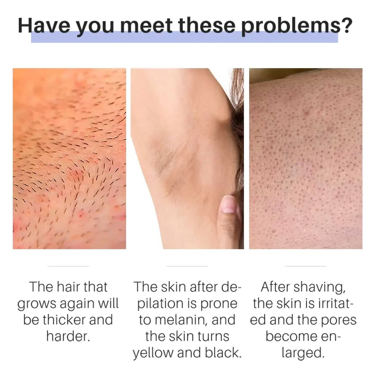 50g Hair Removal Cream for Unisex Reduce Hair Growth Removal Permanent Cream Beard Intimate Legs Body Armpit Painless Depilatory