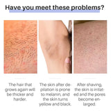 50g Hair Removal Cream for Unisex Reduce Hair Growth Removal Permanent Cream Beard Intimate Legs Body Armpit Painless Depilatory