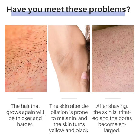 50g Hair Removal Cream for Unisex Reduce Hair Growth Removal Permanent Cream Beard Intimate Legs Body Armpit Painless Depilatory