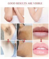Body Whitening Cream Private Parts Bleach Arm Knees Lip Dark Skin Brighten Melanin Intimate Area Pink Essence Moisturizing Care