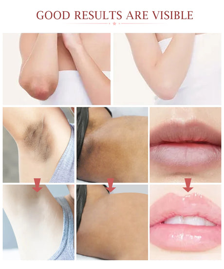 Body Whitening Cream Private Parts Bleach Arm Knees Lip Dark Skin Brighten Melanin Intimate Area Pink Essence Moisturizing Care