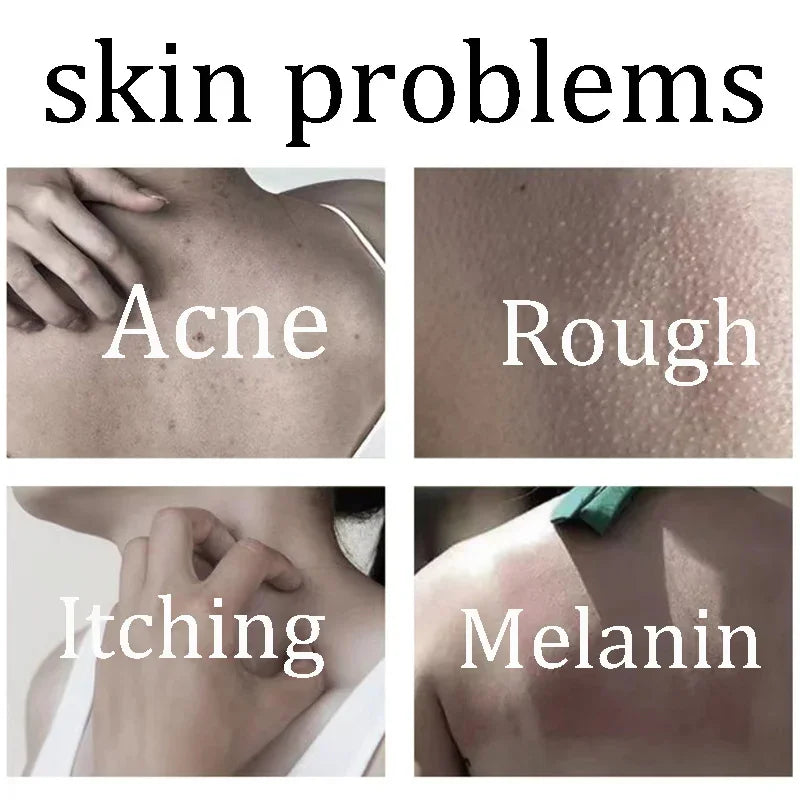 Body Whitening Soap Deep Skin Bleaching Brighten Body Scrub Knees Intimate Parts Armpits White Nourishing Care Soap