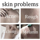 Body Whitening Soap Deep Skin Bleaching Brighten Body Scrub Knees Intimate Parts Armpits White Nourishing Care Soap