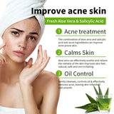 1/2/4/6Pcs Aloe Vera Whitening Soap, Remove Acne, Pimples, Skin Radiant, Improve Skin Luster, Vegan Bath Wash for All Skin Types