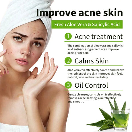 1/2/4/6Pcs Aloe Vera Whitening Soap, Remove Acne, Pimples, Skin Radiant, Improve Skin Luster, Vegan Bath Wash for All Skin Types