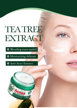 SADOER Tea Tree Acne Removing Face Cream Anti Acne Hydrating Oil Control Moisturizing Facial Creams Face Skin Care Products
