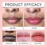 Remove Dark Lip Balm Fast Lightening Pink Lip Exfoliating Fade Lip Line Dead Skin Moisturizer Korean Care Products Beauty Health