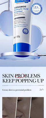 Salicylic Acid Cleansing Facial Cleanser Oil Control Anti-Acne Skin Care Whitening Cleanser Gentle Mild Facial Cleanser
