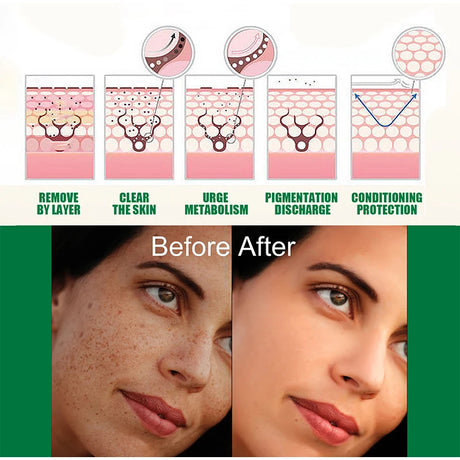 Dark Spot Correcting Glow Serum,Dullness,Acne,And Melanin Remover,Niacinamide Facial Skin Moisturizing Brightening Skincare