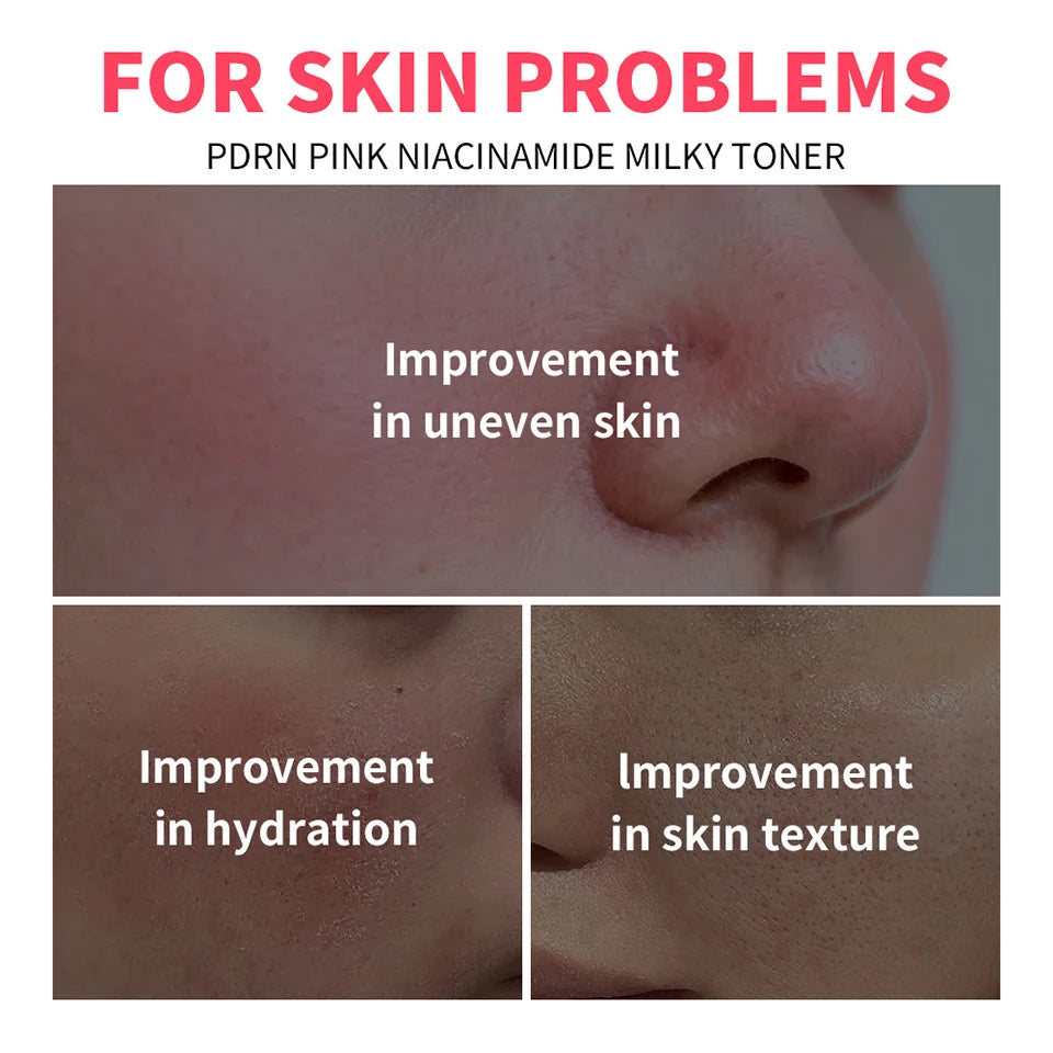 PDRN Pink Niacinamide Milky Toner for Hydrating Moisturizing Soothing Ceramide Glass Glow Skin Milky Toner Korean Skincare
