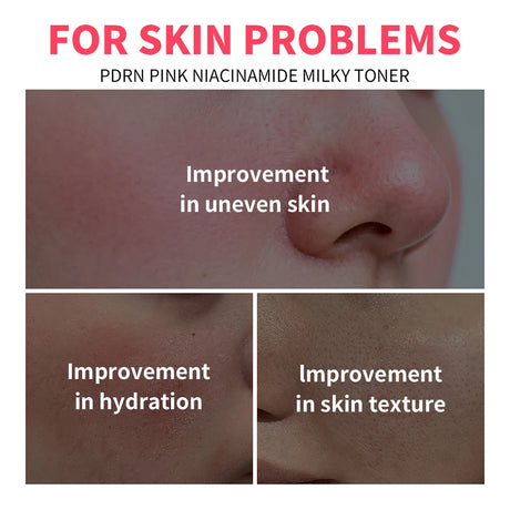 PDRN Pink Niacinamide Milky Toner for Hydrating Moisturizing Soothing Ceramide Glass Glow Skin Milky Toner Korean Skincare