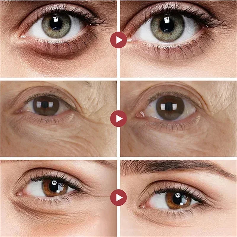 Caviar Eye Bag Removal Cream Hyaluronic Acid Anti-Wrinkle Firming Skin Fade Fine Lines Anti Dark Circle Puffiness Eye Care 20g