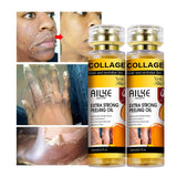 AILKE Collagen Extra Strong Peeling Oil, Whitening Skin, Exfoliating Solution for Face, Body, Hand, Feet, for All Skin Types