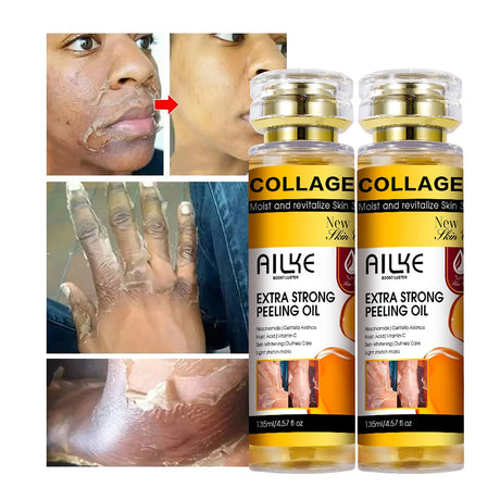 AILKE Collagen Extra Strong Peeling Oil, Whitening Skin, Exfoliating Solution for Face, Body, Hand, Feet, for All Skin Types