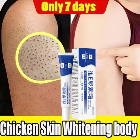 Keratosis Pilaris Repair Treatment Cream Exfoliating Removal Chicken Skin Cleaning Acne Spots Moisturizing Smooth Body Skin Care