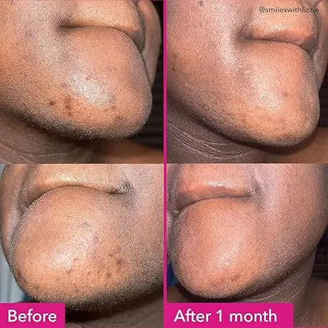 Arbutin 3 Collagen Facial Soap Moisturizing Brightening Deep Cleansing Body Face Wash Foam Facial Cleanser Handmade Soap