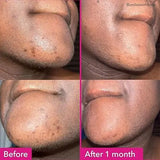 Arbutin 3 Collagen Facial Soap Moisturizing Brightening Deep Cleansing Body Face Wash Foam Facial Cleanser Handmade Soap