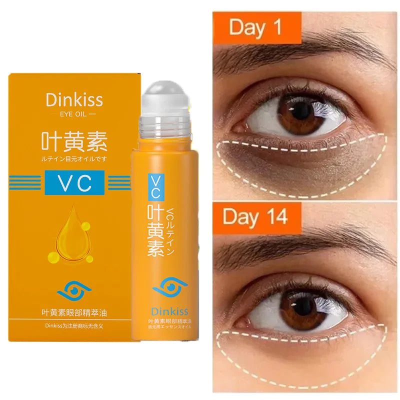 Anti Dark Circle Eye Serum Oil Retinol Anti Wrinkle Firming Lift Skin Remove Eyes Bag Fade Fine Line Whitening Brighten Eye Care