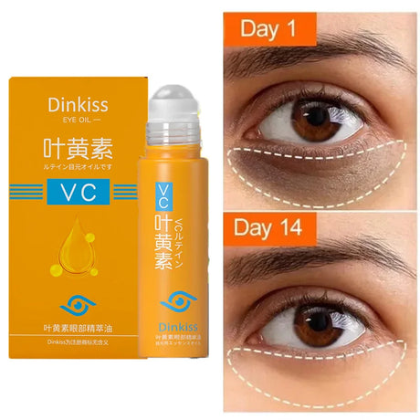 Anti Dark Circle Eye Serum Oil Retinol Anti Wrinkle Firming Lift Skin Remove Eyes Bag Fade Fine Line Whitening Brighten Eye Care