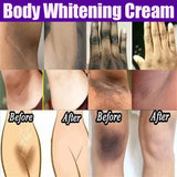Body Whitening Cream Private Parts Underarm Bleaching Serum Whiten Butt Knee Brighten Inner Thigh Intimate Dark Remove Melanin