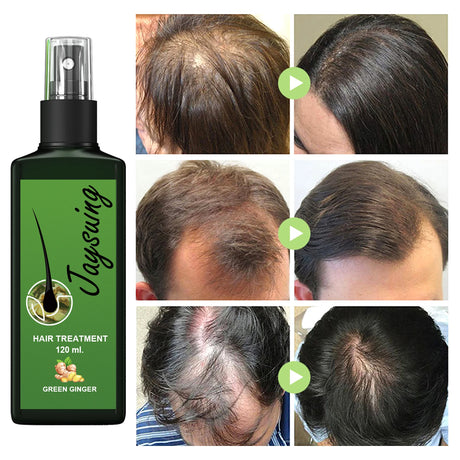Hair Care Spray Ginger Massage Scalp Improve Dry Damaged Serum Smooth Nourish Repair Roots Anti Hair Loss Essence For Men Women