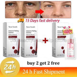 Remove Large Pores Serum Salicylic Acid Facial Pore Shrinking Tightening Pore Minimizing Firming Smooth Essence Korean Skin Care