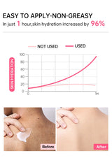 Chicken Skin Removal Cream Body Curing Keratosis Follicle Pore Spot Dull Treatment Whitening Moisturizing Body Care JoyPretty
