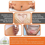 TRSTAY Stretch Mark Scar Repair Cream Enhances Skin Elasticity Moisture Collagen Improvement Safe And Effective