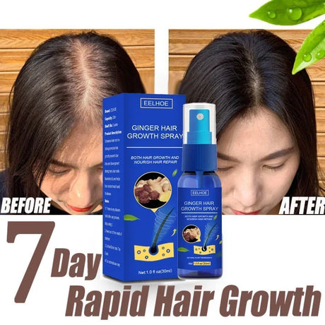 Ginger Hair Growth spray Anti  Fall  Loss Treatment   Essence Oil for Men Women hair treatment