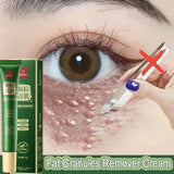 Fat Granules Remover Eye Cream Anti-Puffiness Anti Inflammatory Reduce Dark Circles Eyebags Fade Lines Moisturizing Eye Care