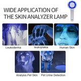 NEW Professional Dermatoscope Skin Medical Magnifier Detection Woods Lamp UVA Lamp For Vitiligo Detection