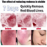 B5 Repair Cream Moisturizing Hydrating Effectively Solves Dry Chapped And Red Skin Nourishes Improve Repair Sunscreen Cream
